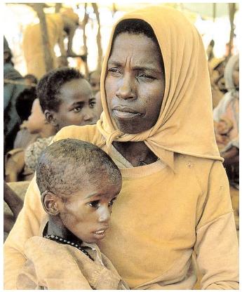 In developing nations, more than half of all deaths among children under five years old are due to malnutrition. Malnourished children who survive may experience stunted growth, illness, and lifelong malnourishment. [Photograph by Bruce Brander. National Audubon Society Collection/Photo Researchers, Inc. Reproduced by permission.]